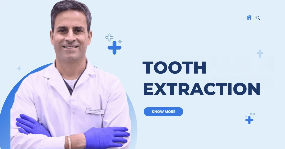 Best Dentist in Calgary for Tooth Extraction: Dr G P Bhattal