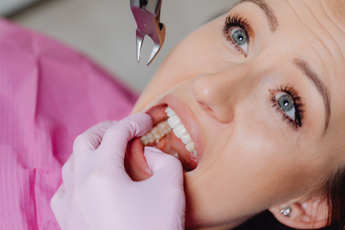 Best Dentist in Calgary for tooth extraction