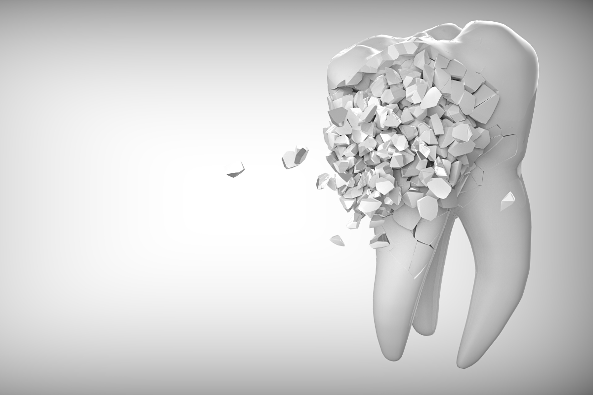 tooth extraction in calgary