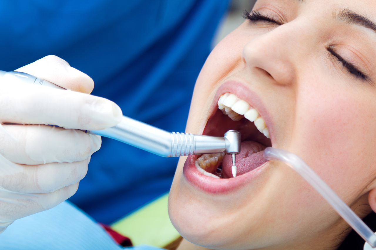 Tips to Prevent Dental Emergencies​